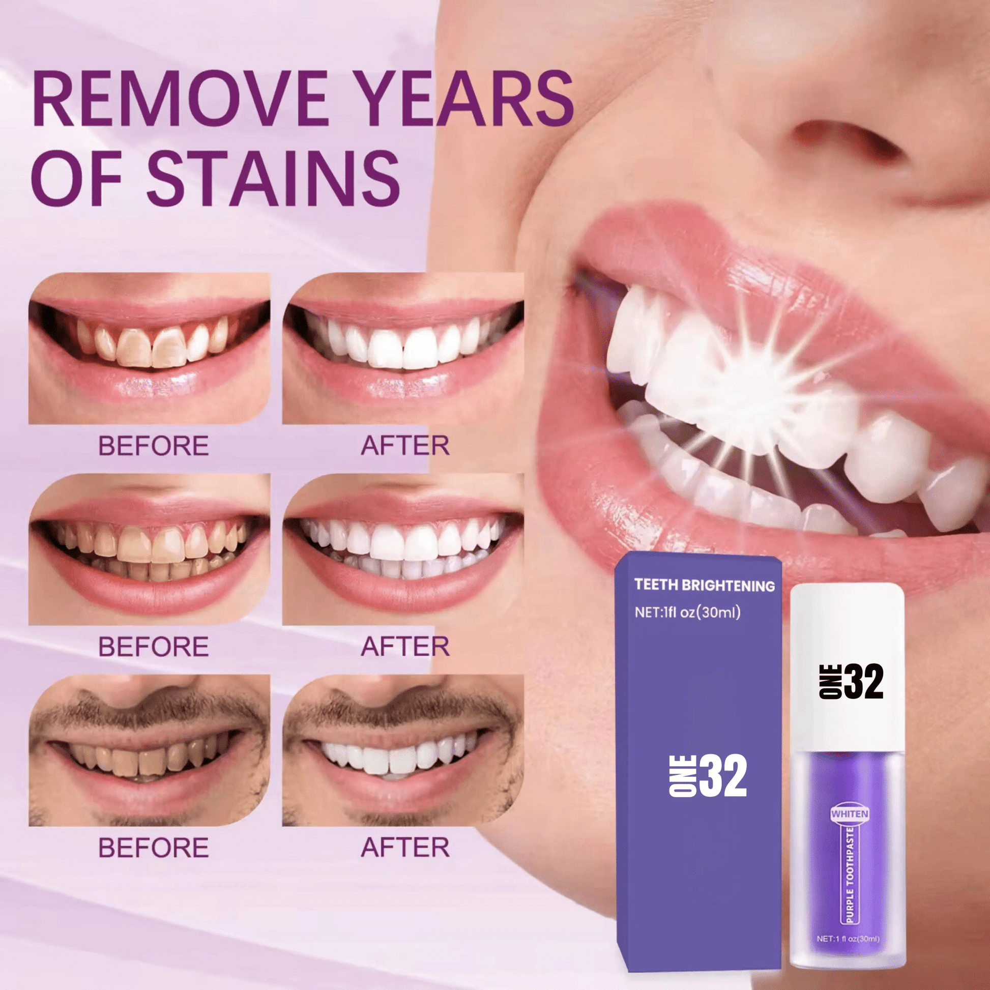 ONE32 Teeth Whitening Toothpaste - ONE32